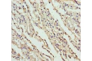 Immunohistochemistry of paraffin-embedded human lung tissue using ABIN7149964 at dilution of 1:100