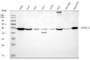 Western blot analysis of GLUD1/2 using anti-GLUD1/2 antibody (ABIN7602000). (GLUD1 / GLUD2 (AA 54-553) antibody)