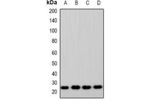 Western blot analysis of ZNRF2 expression in HEK293T (A), A549 (B), RAW264. (ZNRF2 antibody  (C-Term))