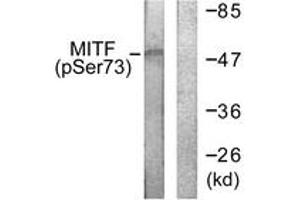 Western blot analysis of extracts from COS7 cells, using MITF (Phospho-Ser180/73) Antibody. (MITF antibody  (pSer180))