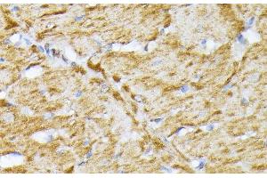 Immunohistochemistry of paraffin-embedded Rat heart using SLC25A5 Polyclonal Antibody at dilution of 1:100 (40x lens). (SLC25A5 antibody)