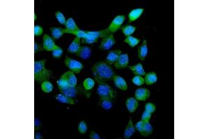IF analysis of eRF1/ETF1 using anti-eRF1/ETF1 antibody (ABIN7602626). (ETF1 antibody  (AA 9-342))