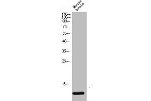 anti-Vesicle-Associated Membrane Protein 1 (Synaptobrevin 1) (VAMP1) (Internal Region) antibody