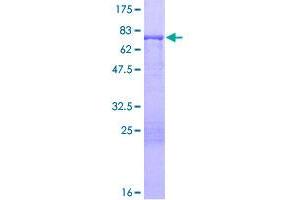 Image no. 1 for Keratin 13 (KRT13) (AA 1-458) protein (GST tag) (ABIN1308956) (Cytokeratin 13 Protein (AA 1-458) (GST tag))