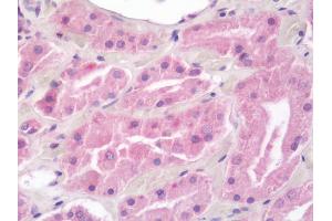 Immunohistochemistry (IHC) image for anti-V-Akt Murine Thymoma Viral Oncogene Homolog 3 (Protein Kinase B, Gamma) (AKT3) (AA 2-479) antibody (ABIN2615484)