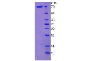 Image no. 1 for Asporin (ASPN) (AA 16-373) protein (His tag,GST tag) (ABIN4989162)
