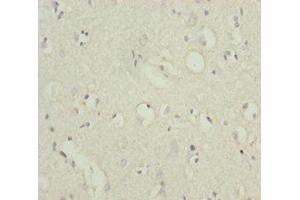 IHC analysis of paraffin-embedded human brain tissue, using POU4F3 antibody (1/100 dilution). (POU4F3 antibody  (AA 1-180))