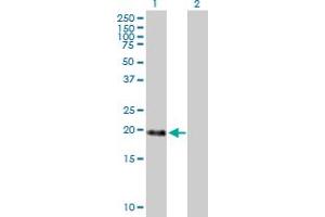 Western Blot analysis of MBD3L1 expression in transfected 293T cell line by MBD3L1 MaxPab polyclonal antibody. (MBD3L1 antibody  (AA 1-194))