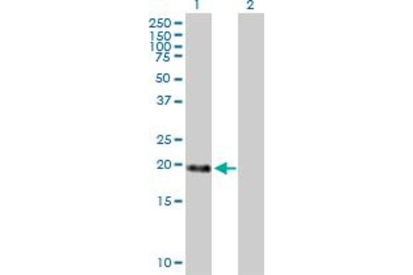 MBD3L1 Antikörper  (AA 1-194)