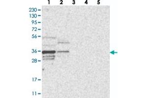 Western blot analysis of Lane 1: RT-4, Lane 2: U-251 MG, Lane 3: Human Plasma, Lane 4: Liver, Lane 5: Tonsil with OTUD6B polyclonal antibody  at 1:250-1:500 dilution. (OTUD6B antibody)