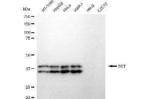 Western blotting analysis using SET antibody (ABIN7800325).