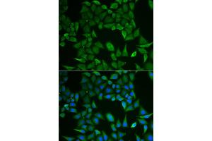 Immunofluorescence analysis of HeLa cells using CLPS antibody.