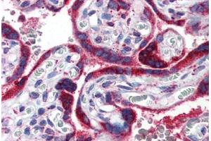 Immunohistochemistry (Paraffin-embedded Sections) (IHC (p)) image for anti-Peroxisome Proliferator-Activated Receptor gamma (PPARG) (AA 1-16) antibody (ABIN351540)