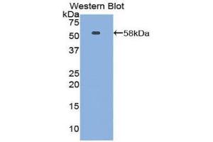 Western Blotting (WB) image for anti-Netrin 1 (NTN1) (AA 313-565) antibody (ABIN1860070) (Netrin 1 antibody  (AA 313-565))