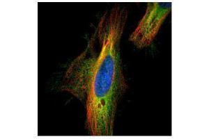 ICC/IF Image Confocal immunofluorescence analysis (Olympus FV10i) of paraformaldehyde-fixed HeLa, using DIAPH1, antibody (Green) at 1:500 dilution. (DIAPH1 antibody  (N-Term))