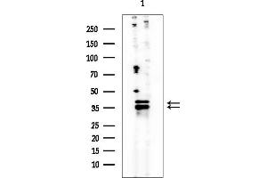anti-CAAX Prenyl Protease 2 (RCE1) antibody