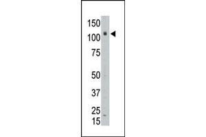 The anti-LAF4 Pab (ABIN6243472 and ABIN6578970) is used in Western blot to detect LAF4 in placenta tissue lysate.