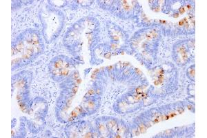 Formalin-fixed, paraffin-embedded human Colon stained with CEA Mouse Monoclonal Antibody (C66/1291). (CEACAM5 antibody)