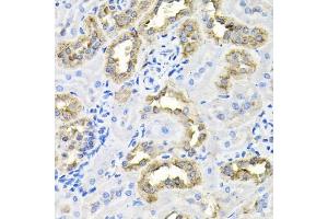 Immunohistochemistry of paraffin-embedded rat kidney using CDC antibody (ABIN6127612, ABIN6138273, ABIN6138274 and ABIN6216282) at dilution of 1:100 (40x lens). (CDCA8 antibody  (AA 1-280))