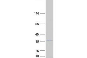 Validation with Western Blot