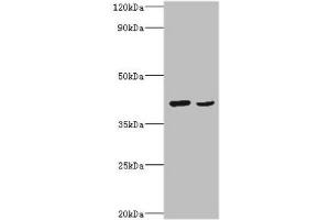 Western blot All lanes: Protein Wnt-2 antibody at 2 μg/mL Lane 1: HepG2 whole cell lysate Lane 2: MCF-7 whole cell lysate Secondary Goat polyclonal to rabbit IgG at 1/10000 dilution Predicted band size: 40 kDa Observed band size: 40 kDa (WNT2 antibody  (AA 26-360))