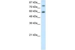 Western Blotting (WB) image for anti-Cleavage Stimulation Factor, 3' Pre-RNA, Subunit 3, 77kDa (CSTF3) antibody (ABIN2462105) (CSTF3 antibody)