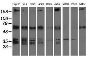 Image no. 2 for anti-Insulin-Like Growth Factor 2 mRNA Binding Protein 2 (IGF2BP2) antibody (ABIN1498825) (IGF2BP2 antibody)