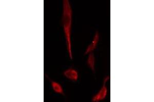 ABIN6274965 staining  Hela cells by IF/ICC. (CBR3 antibody  (C-Term))