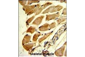 Immunohistochemistry (Paraffin-embedded Sections) (IHC (p)) image for anti-Four and A Half LIM Domains 1 (FHL1) (AA 214-240), (C-Term) antibody (ABIN390835)