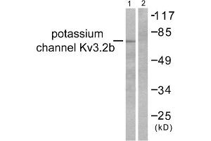 Western blot analysis of extracts from HepG2 cells, using Potassium Channel Kv3. (Kv3.2b Potassium Channel antibody  (C-Term))