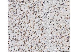 IHC analysis of RPL10 using anti-RPL10 antibody (ABIN7601177). (RPL10 antibody  (AA 3-214))