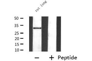 Western blot analysis of extracts from rat lung, using STAR  Antibody.