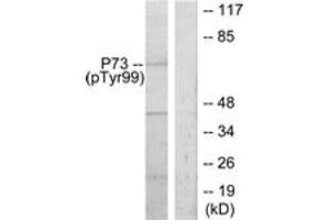 Western blot analysis of extracts from K562 cells treated with Pervanadate, using p73 (Phospho-Tyr99) Antibody.