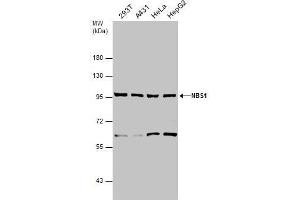 WB Image Various whole cell extracts (30 μg) were separated by 7. (Nibrin antibody)