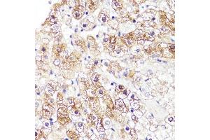 Immunohistochemistry of paraffin-embedded human liver using CYP3 antibody (ABIN3023345, ABIN3023346, ABIN3023347 and ABIN6219639) at dilution of 1:100 (40x lens). (CYP3A4 antibody  (AA 244-503))