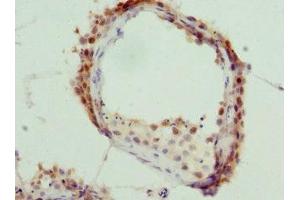 Immunohistochemistry of paraffin-embedded human testis tissue using ABIN7157482 at dilution of 1:100 (KHDRBS3 antibody  (AA 177-346))