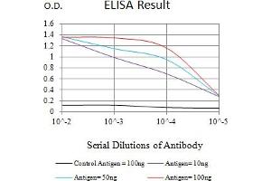 Black line: Control Antigen (100 ng),Purple line: Antigen (10 ng), Blue line: Antigen (50 ng), Red line:Antigen (100 ng) (Calreticulin antibody  (AA 18-417))