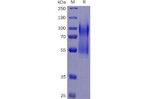 Human CD34 Protein, His Tag on SDS-PAGE under reducing condition. (CD34 Protein (CD34) (His tag))