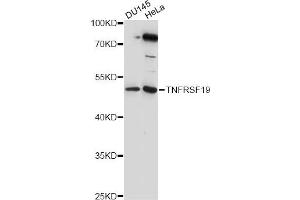 Western blot analysis of extracts of various cell lines, using TNFRSF19 antibody (ABIN6290995) at 1:1000 dilution. (TNFRSF19 antibody)