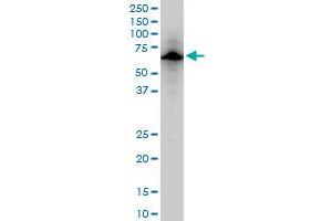 USP14 polyclonal antibody (A01), Lot # 060707JCS1. (USP14 antibody  (AA 395-494))