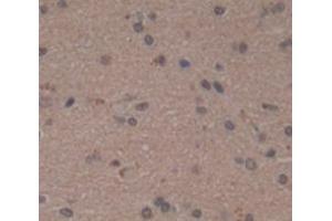 IHC-P analysis of Human Tissue, with DAB staining. (SPTBN4 antibody  (AA 64-285))