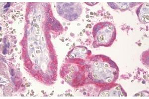 Anti-CGB / hCG Beta antibody IHC staining of human placenta, trophoblast. (CGB antibody  (AA 101-150))