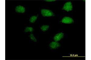 Immunofluorescence of purified MaxPab antibody to ZBTB32 on HeLa cell. (ZBTB32 antibody  (AA 1-302))