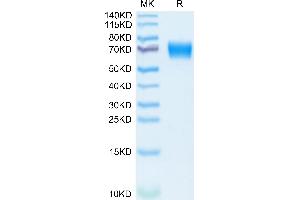 Mouse IL-18 R1 on Tris-Bis PAGE under reduced condition. (IL18R1 Protein (AA 20-326) (His tag))