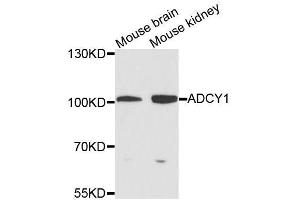 Western blot analysis of extracts of various cell lines, using ADCY1 antibody (ABIN5996345) at 1/1000 dilution.