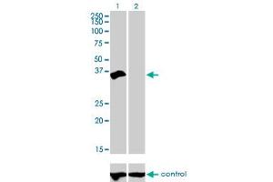 Western blot analysis of HOXD8 over-expressed 293 cell line, cotransfected with HOXD8 Validated Chimera RNAi (Lane 2) or non-transfected control (Lane 1).