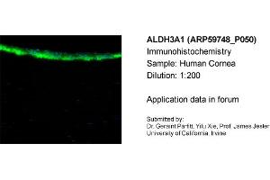 Sample Type: Human CorneaDilution: 1:200 (ALDH3A1 antibody  (N-Term))