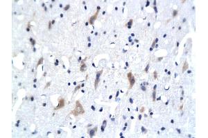 Formalin-fixed and paraffin embedded rat brain labeled with Anti- 5-HTR3Polyclonal Antibody, Unconjugated (ABIN677813) followed by conjugation to the secondary antibody and DAB staining (Serotonin Receptor 3A antibody  (AA 301-400))