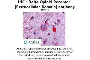 Image no. 1 for anti-Opioid Receptor, delta 1 (OPRD1) (3rd Extracellular Domain) antibody (ABIN1733580)