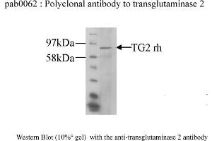 Image no. 1 for anti-Transglutaminase 2 (C Polypeptide, Protein-Glutamine-gamma-Glutamyltransferase) (TGM2) antibody (ABIN347019) (Transglutaminase 2 antibody)